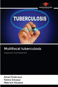 bokomslag Multifocal tuberculosis