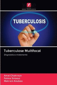 bokomslag Tuberculose Multifocal