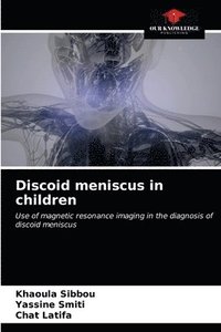 bokomslag Discoid meniscus in children