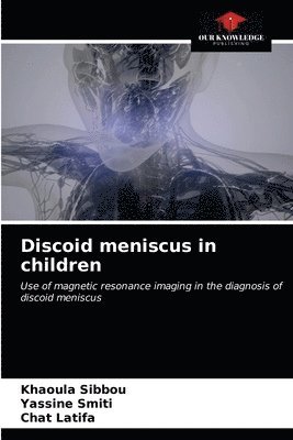 Discoid meniscus in children 1