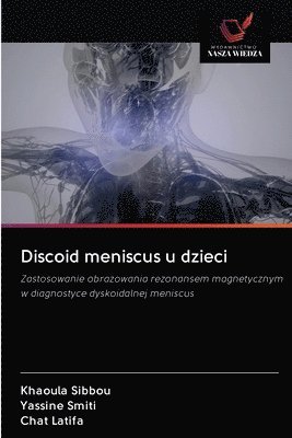 Discoid meniscus u dzieci 1