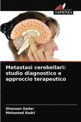 Metastasi cerebellari 1