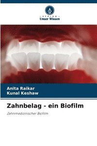 bokomslag Zahnbelag - ein Biofilm