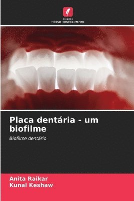 Placa dentria - um biofilme 1