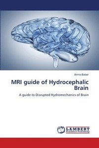 bokomslag MRI guide of Hydrocephalic Brain