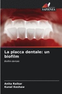 bokomslag La placca dentale