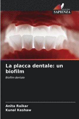 bokomslag La placca dentale