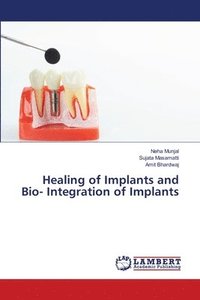 bokomslag Healing of Implants and Bio- Integration of Implants