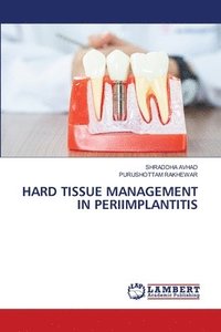 bokomslag Hard Tissue Management in Periimplantitis