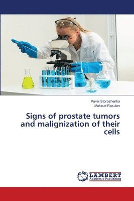 Signs of prostate tumors and malignization of their cells 1