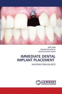 bokomslag Immediate Dental Implant Placement