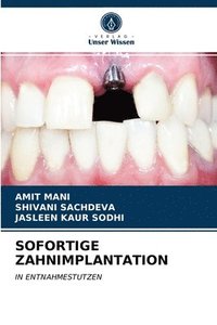bokomslag Sofortige Zahnimplantation