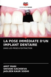bokomslag La Pose Immediate d'Un Implant Dentaire