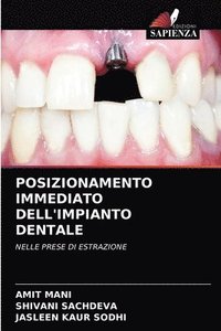 bokomslag Posizionamento Immediato Dell'impianto Dentale