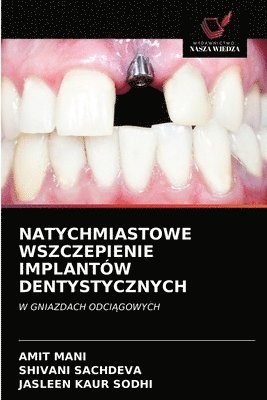 bokomslag Natychmiastowe Wszczepienie Implantów Dentystycznych