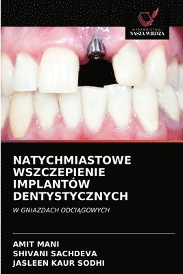 bokomslag Natychmiastowe Wszczepienie Implantow Dentystycznych