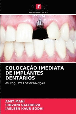 bokomslag Colocacao Imediata de Implantes Dentarios