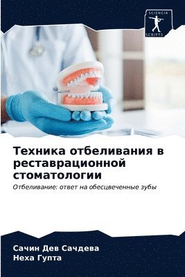 &#1058;&#1077;&#1093;&#1085;&#1080;&#1082;&#1072; &#1086;&#1090;&#1073;&#1077;&#1083;&#1080;&#1074;&#1072;&#1085;&#1080;&#1103; &#1074; 1