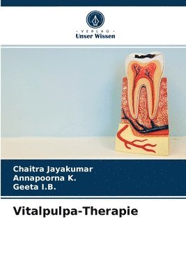 Vitalpulpa-Therapie 1