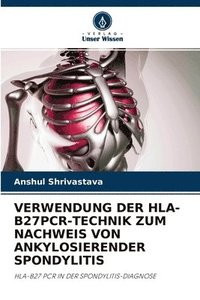 bokomslag Verwendung Der Hla-B27pcr-Technik Zum Nachweis Von Ankylosierender Spondylitis