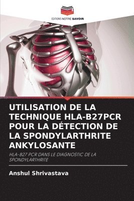 Utilisation de la Technique Hla-B27pcr Pour La Dtection de la Spondylarthrite Ankylosante 1