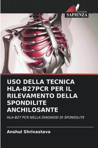 bokomslag USO Della Tecnica Hla-B27pcr Per Il Rilevamento Della Spondilite Anchilosante