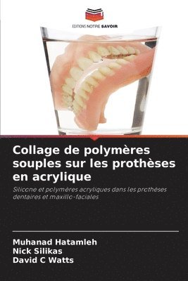 Collage de polymres souples sur les prothses en acrylique 1