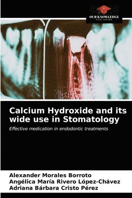 Calcium Hydroxide and its wide use in Stomatology 1