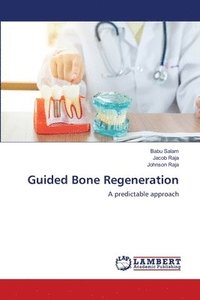 bokomslag Guided Bone Regeneration