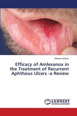 Efficacy of Amlexanox in the Treatment of Recurrent Aphthous Ulcers -a Review 1
