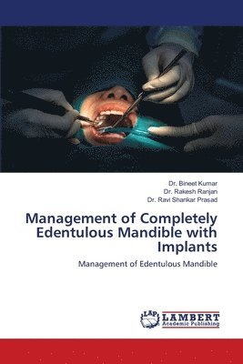 bokomslag Management of Completely Edentulous Mandible with Implants
