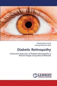 bokomslag Diabetic Retinopathy