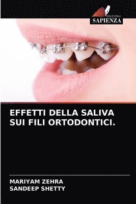 Effetti Della Saliva Sui Fili Ortodontici. 1