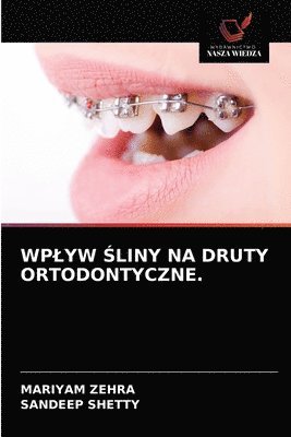 bokomslag Wplyw &#346;liny Na Druty Ortodontyczne.