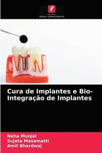 bokomslag Cura de Implantes e Bio- Integrao de Implantes
