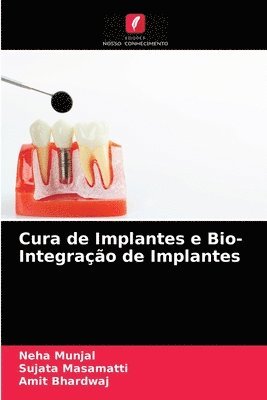 Cura de Implantes e Bio- Integrao de Implantes 1