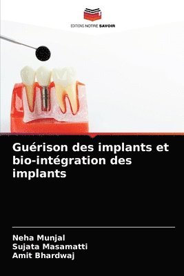 bokomslag Gurison des implants et bio-intgration des implants