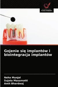 bokomslag Gojenie si&#281; implantw i biointegracja implantw