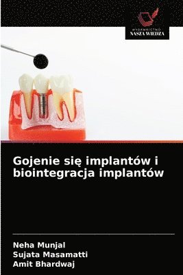bokomslag Gojenie si&#281; implantw i biointegracja implantw