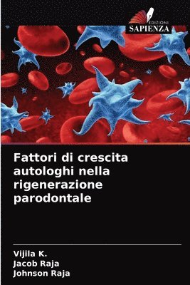 Fattori di crescita autologhi nella rigenerazione parodontale 1