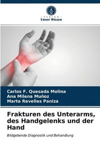 bokomslag Frakturen des Unterarms, des Handgelenks und der Hand
