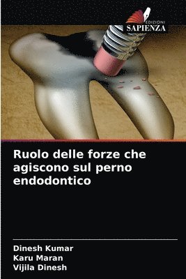 bokomslag Ruolo delle forze che agiscono sul perno endodontico