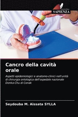 Cancro della cavit orale 1