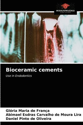 Bioceramic cements 1