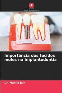 bokomslag Importância dos tecidos moles na implantodontia