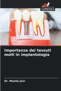 bokomslag Importanza dei tessuti molli in implantologia