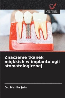 bokomslag Znaczenie tkanek mi?kkich w implantologii stomatologicznej