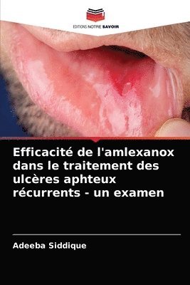 Efficacit de l'amlexanox dans le traitement des ulcres aphteux rcurrents - un examen 1