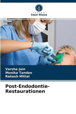 Post-Endodontie-Restaurationen 1