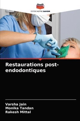Restaurations post-endodontiques 1